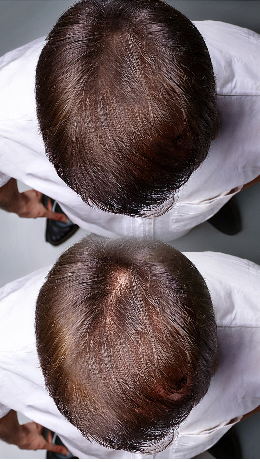 antes y después. Cuidado capilar para hombres, con ingredientes orgánicos, que combate la caída y estimula el crecimiento del cabello